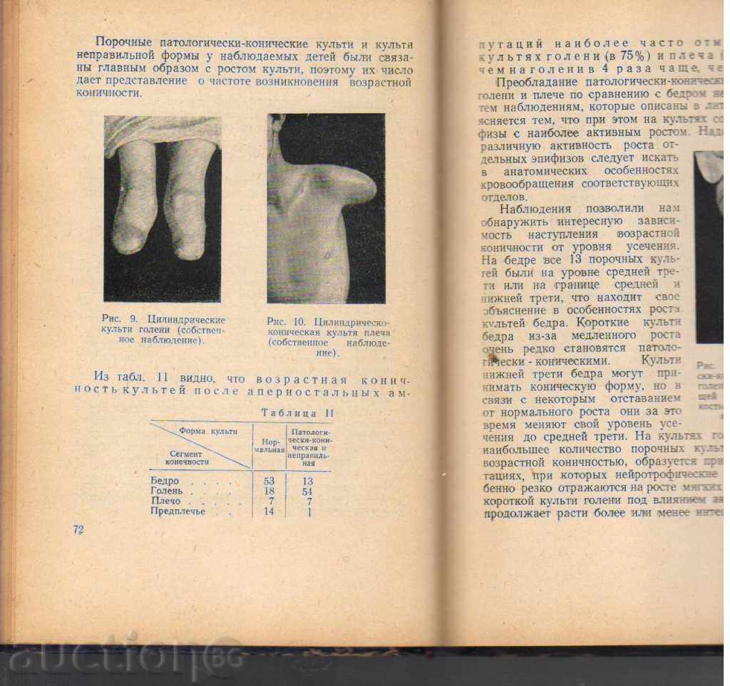 Delivery of Amputations of babies' wings