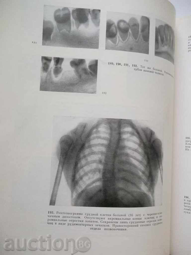 Auction Atlas radiographs of zubov and jelly in norm and pathologies Auction Atlas radiographs of zubov and jelly in norm and pathologies