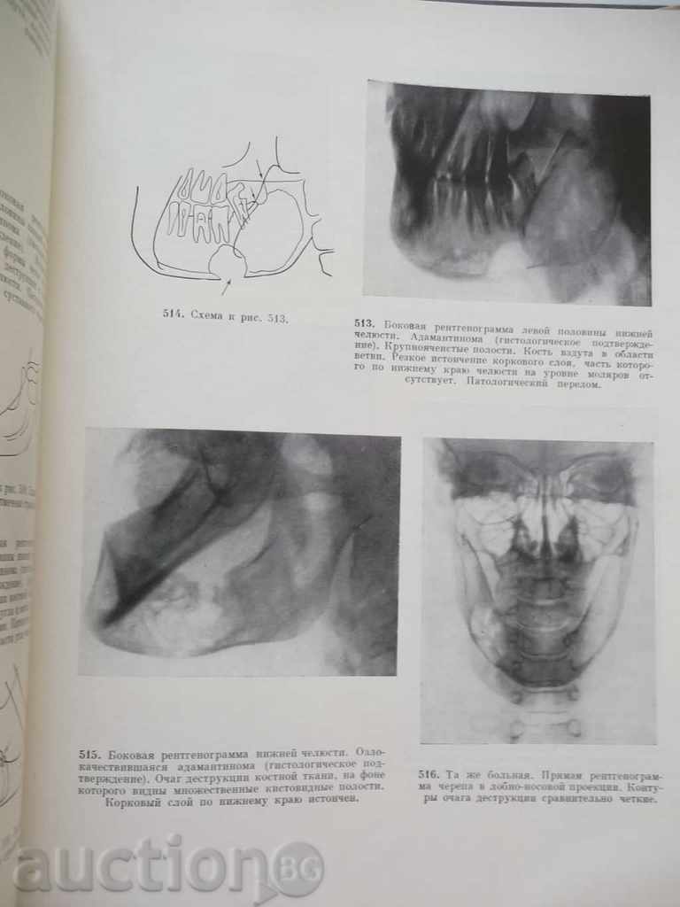 Delivery of Atlas radiographs of zubov and jelly in norm and pathologies Delivery of Atlas radiographs of zubov and jelly in norm and pathologies