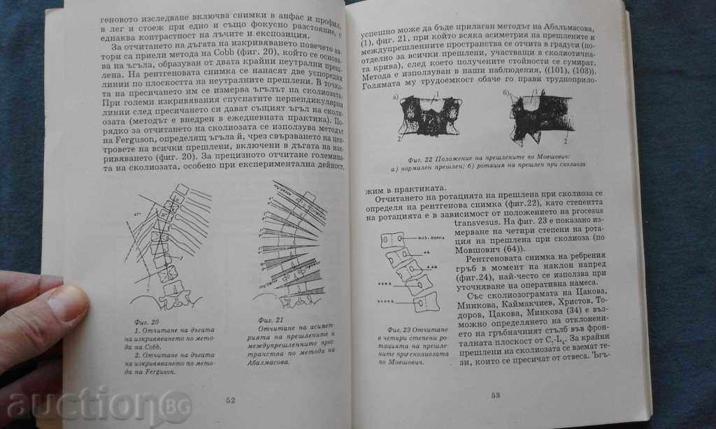 Can the spinal curvatures be treated? "" Chernomorovna - 6 Can the spinal curvatures be treated? "" Chernomorovna - 6