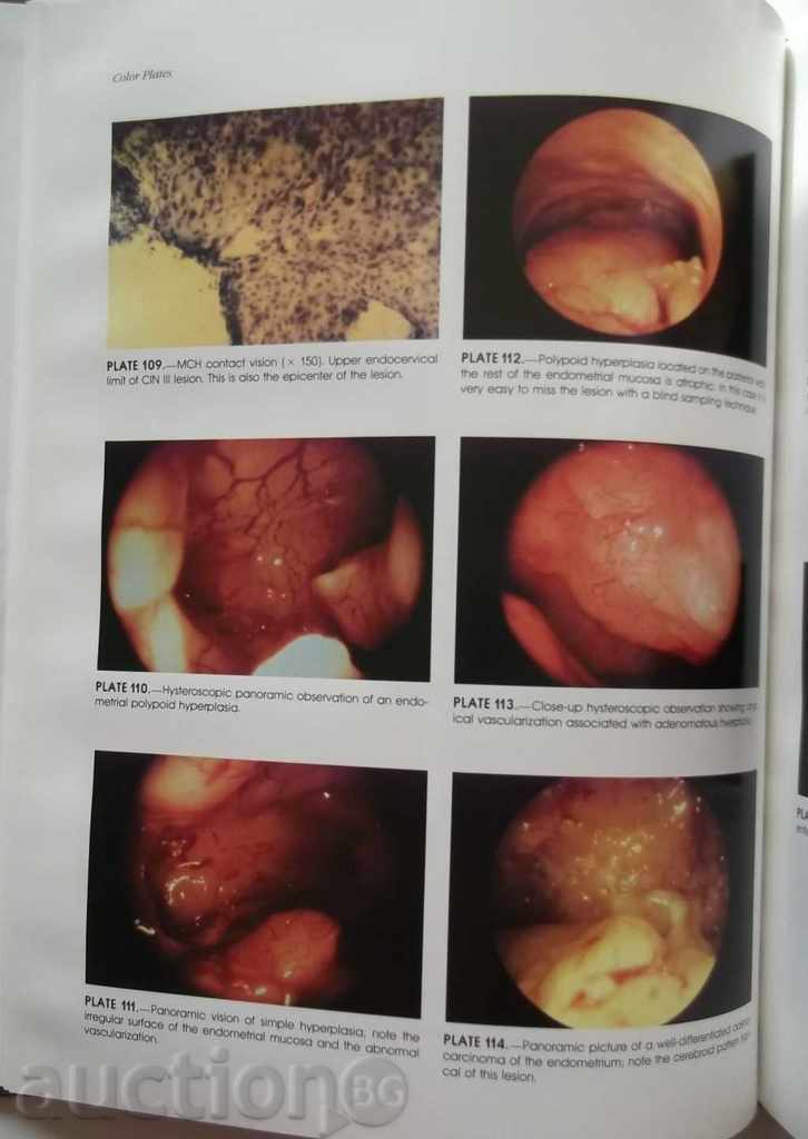 Delivery of Diagnostic and Operative Hysteroscopy: A Text and Atlas Delivery of Diagnostic and Operative Hysteroscopy: A Text and Atlas
