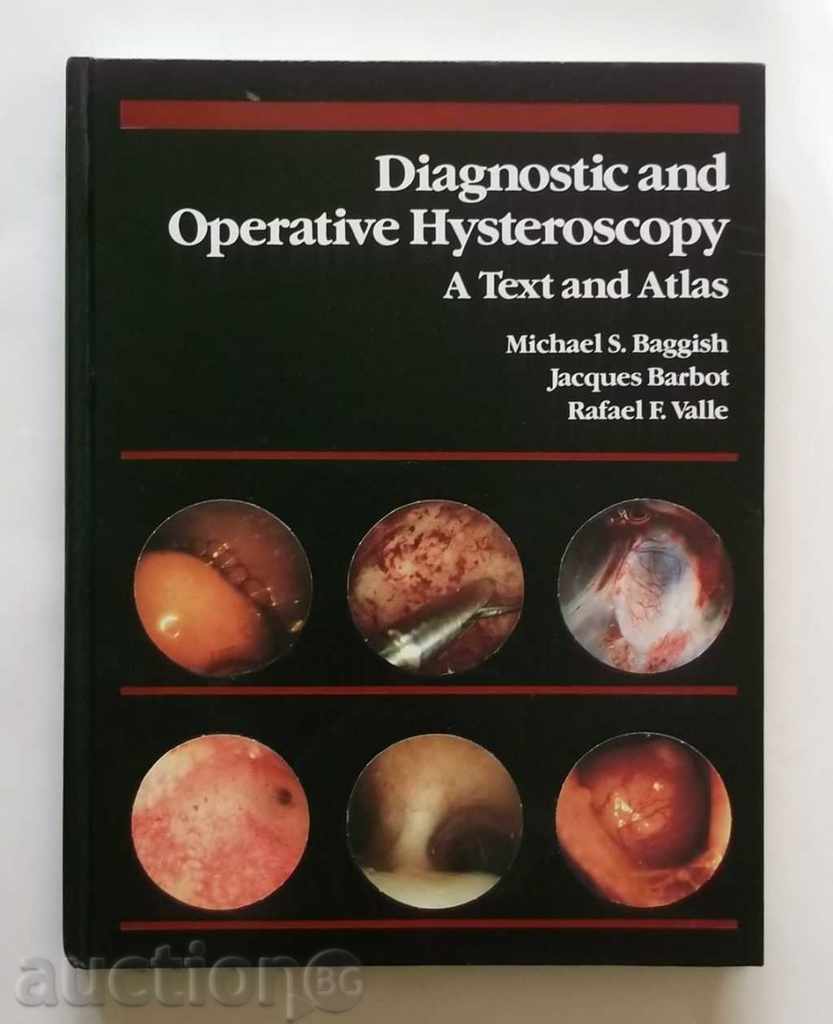 Diagnostic and Operative Hysteroscopy: A Text and Atlas