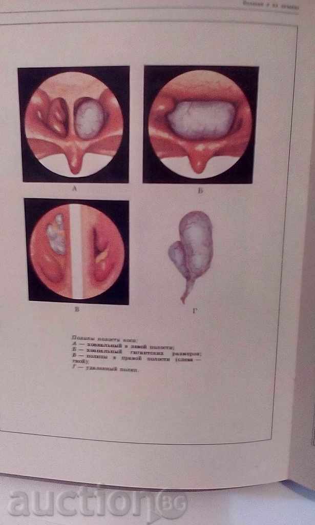 Otorhinolaryngological atlas - Gazanovich, Aleksandrov with price 9.00 BGN | € 4.60 Otorhinolaryngological atlas - Gazanovich, Aleksandrov with price 9.00 BGN | € 4.60