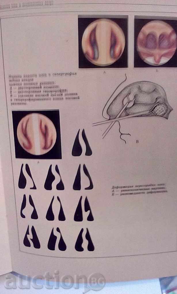 Auction Otorhinolaryngological atlas - Gazanovich, Aleksandrov Auction Otorhinolaryngological atlas - Gazanovich, Aleksandrov