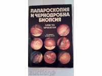 Laparoscopy and liver biopsy - Hristo Brailski