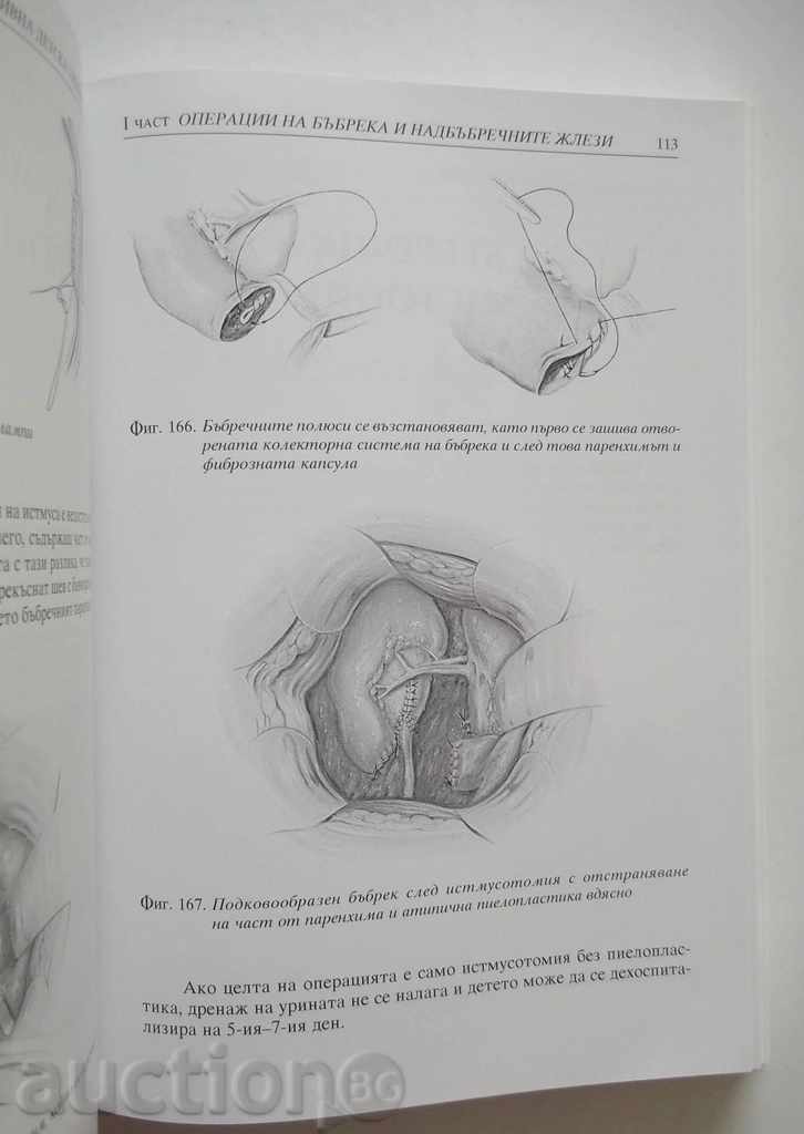 Operational child urology - Marin Minkov 2006 with price 18.00 BGN | € 9.20 Operational child urology - Marin Minkov 2006 with price 18.00 BGN | € 9.20