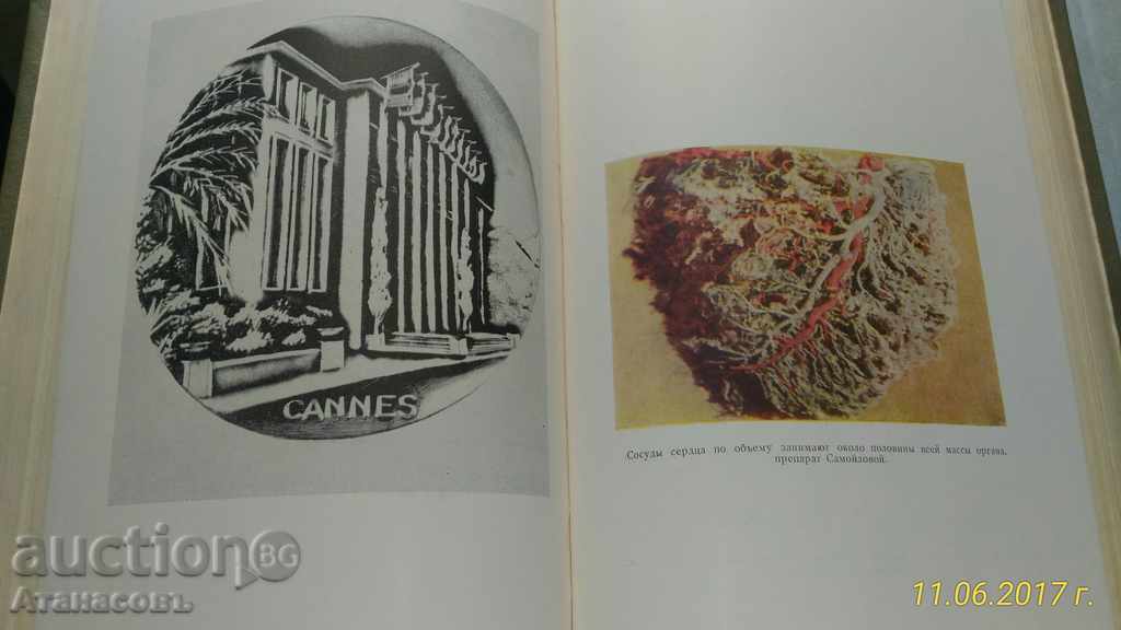 150 Cro Sheremetevskoy bolnitsы 1963 - 5 150 Cro Sheremetevskoy bolnitsы 1963 - 5