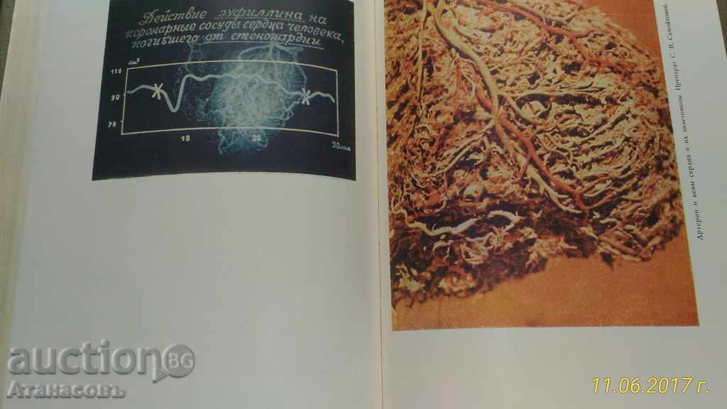 150 Cro Sheremetevskoy bolnitsы 1963 - 6 150 Cro Sheremetevskoy bolnitsы 1963 - 6