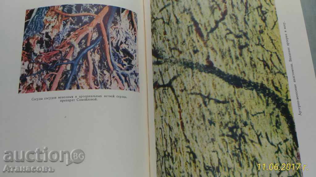 150 Cro Sheremetevskoy bolnitsы 1963 - 7 150 Cro Sheremetevskoy bolnitsы 1963 - 7