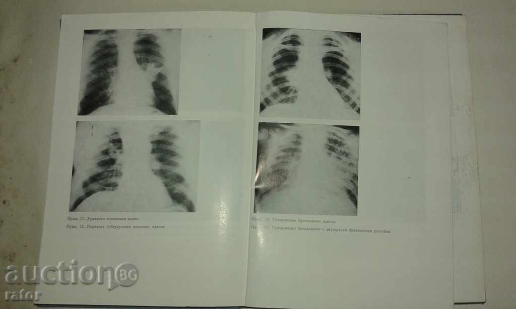 Manual de Medicina Interna Volumul 2. medicină - 5 Manual de Medicina Interna Volumul 2. medicină - 5