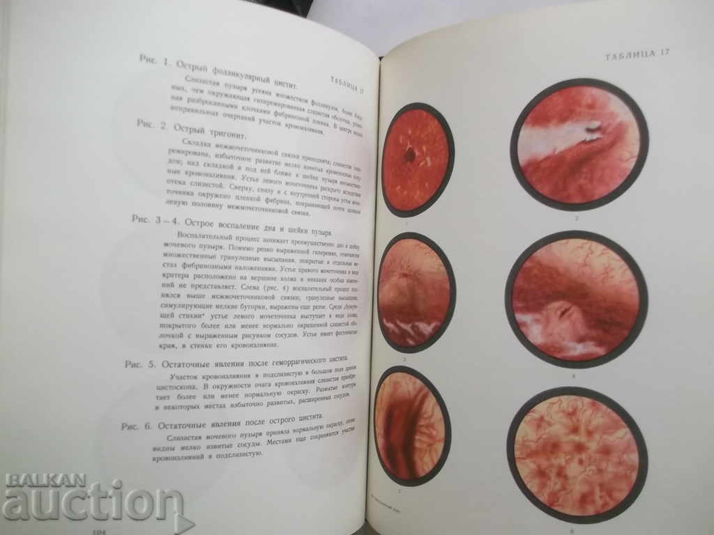 Cistoscopic Atlas - AP Frumkin 1954 autograph - 5 Cistoscopic Atlas - AP Frumkin 1954 autograph - 5