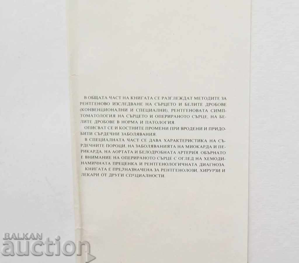 Рентгенова диагностика на сърдечно-съдовите заболявания с цена 15.00 лв. | € 7.67 Рентгенова диагностика на сърдечно-съдовите заболявания с цена 15.00 лв. | € 7.67