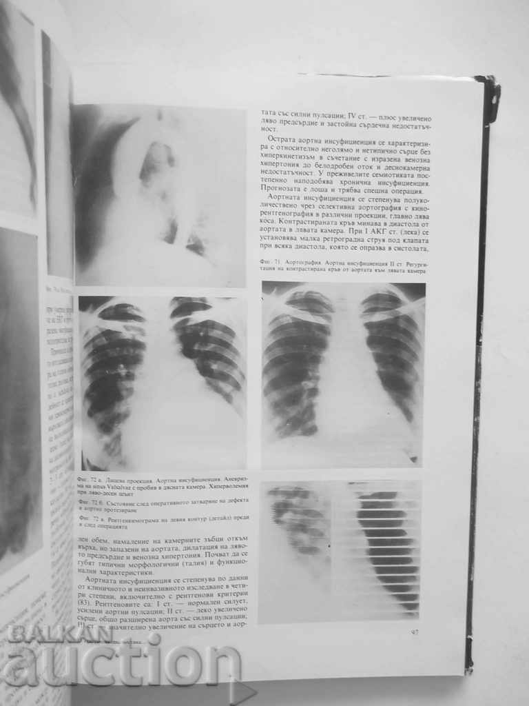 Аукцион Рентгенова диагностика на сърдечно-съдовите заболявания Аукцион Рентгенова диагностика на сърдечно-съдовите заболявания