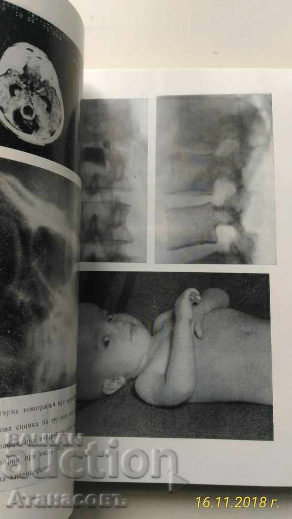 Director de Neurologie Prof. D. Hadziiev I. Georgiev cu preț 25.00 BGN | € 12.78