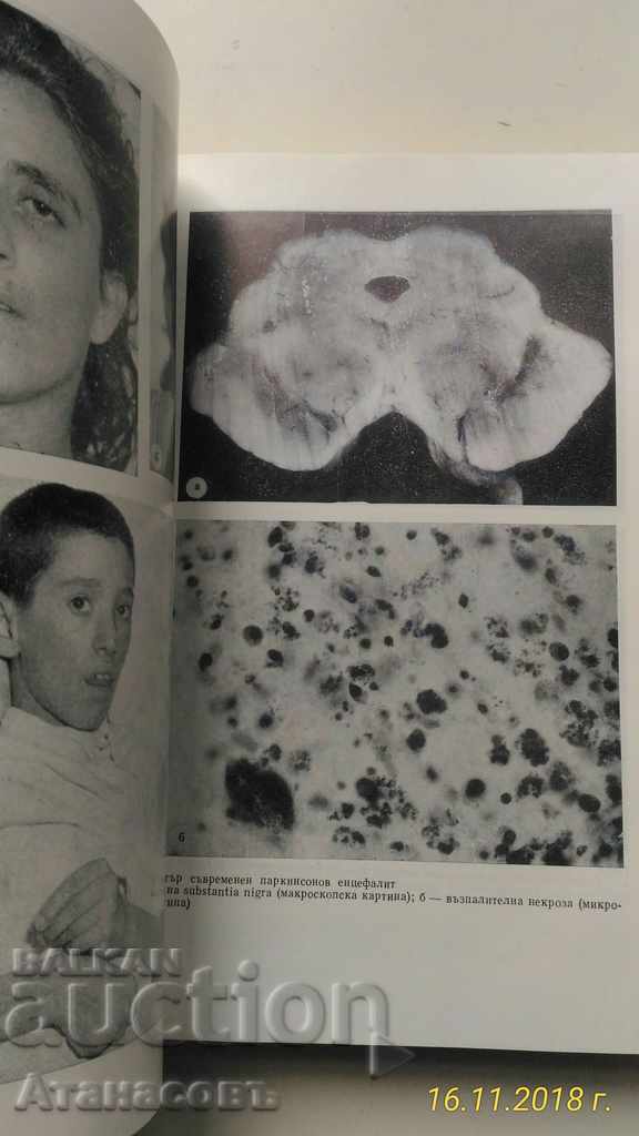 Licitație Director de Neurologie Prof. D. Hadziiev I. Georgiev