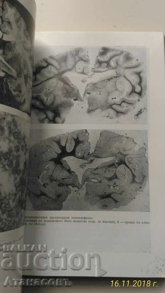 Livrarea Director de Neurologie Prof. D. Hadziiev I. Georgiev