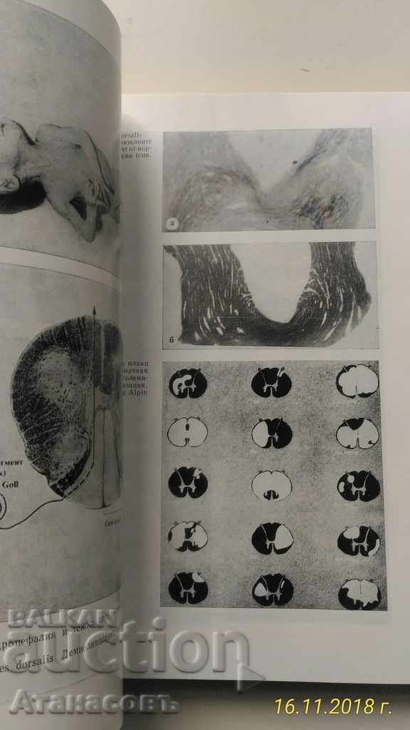 Director de Neurologie Prof. D. Hadziiev I. Georgiev - 6