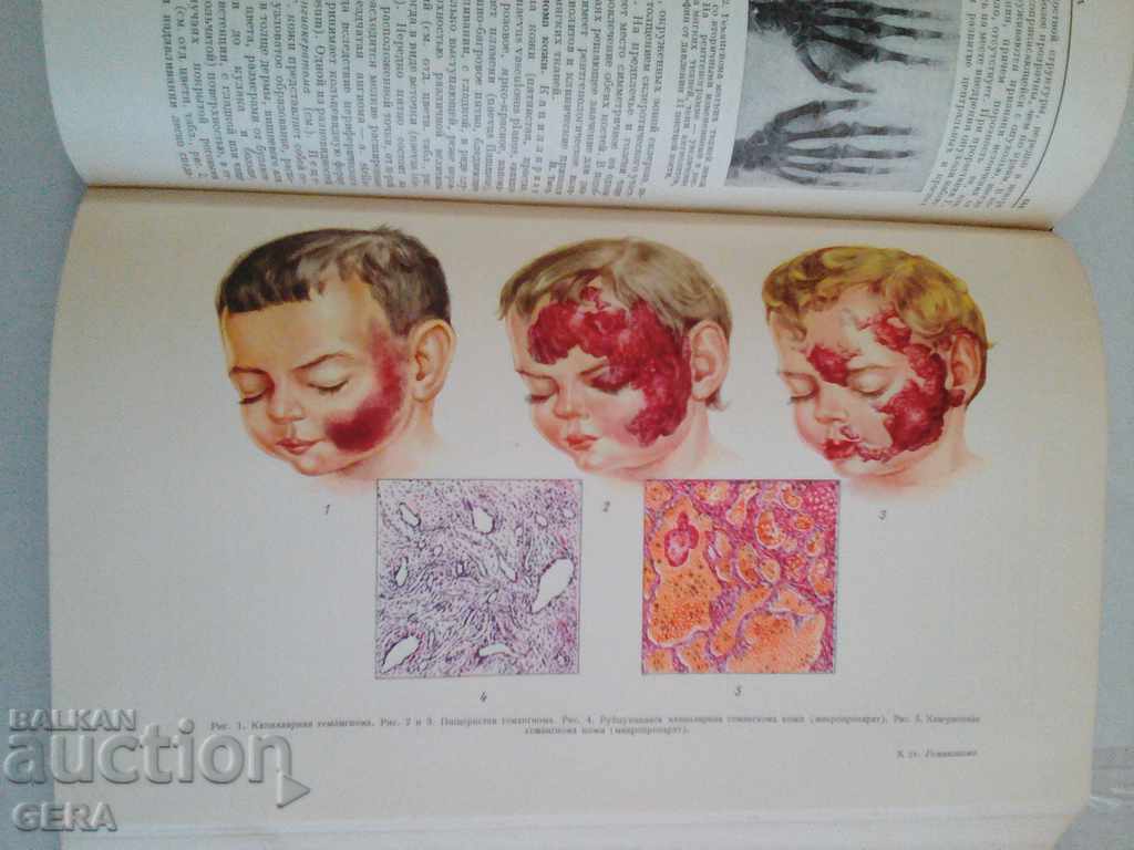 Delivery of books Delivery of books