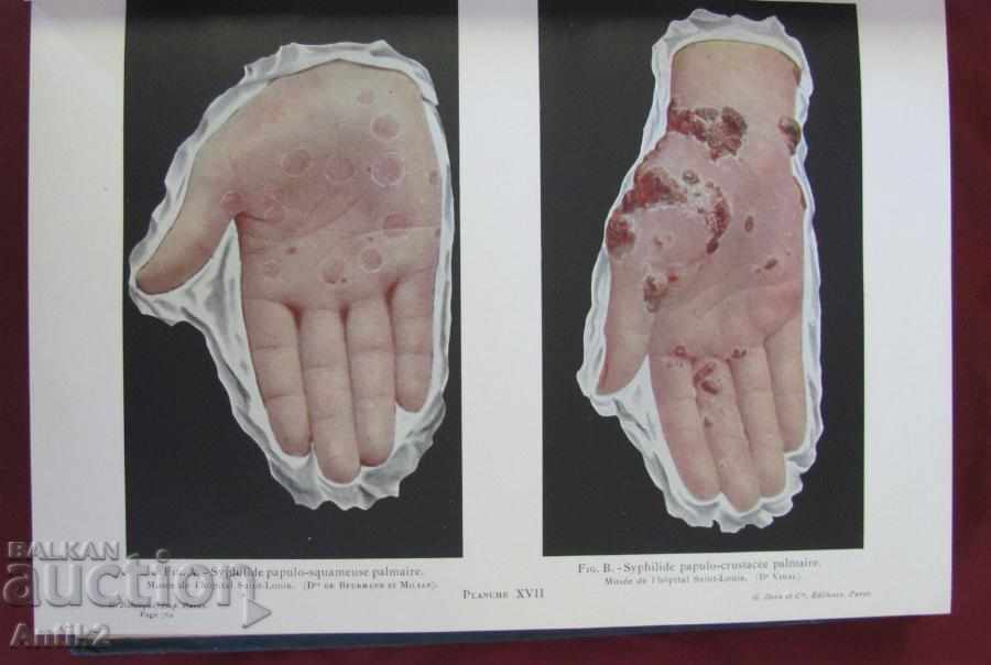Auction 1926 Medical Book Paris PATHOLOGIE INTERNE Auction 1926 Medical Book Paris PATHOLOGIE INTERNE