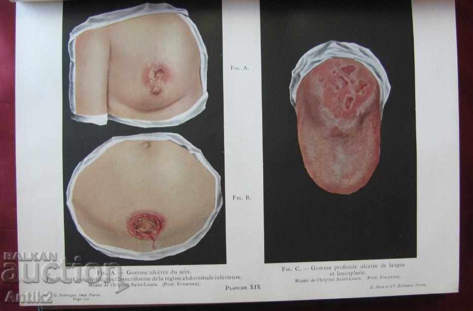 1926 Medical Book Paris PATHOLOGIE INTERNE - 5 1926 Medical Book Paris PATHOLOGIE INTERNE - 5