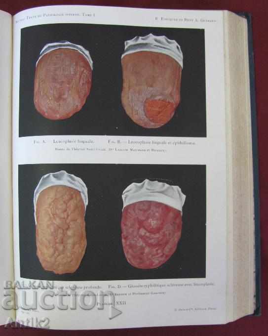 1926 Medical Book Paris PATHOLOGIE INTERNE - 7 1926 Medical Book Paris PATHOLOGIE INTERNE - 7