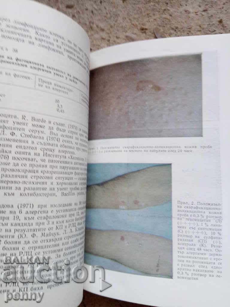 Delivery of Allergic diseases of the eyes - Yu. Maychuk Delivery of Allergic diseases of the eyes - Yu. Maychuk