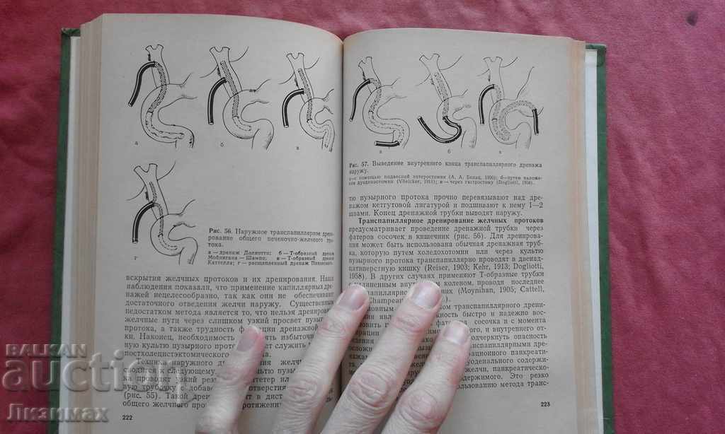 Auction Obstruction of the biliary tract Auction Obstruction of the biliary tract