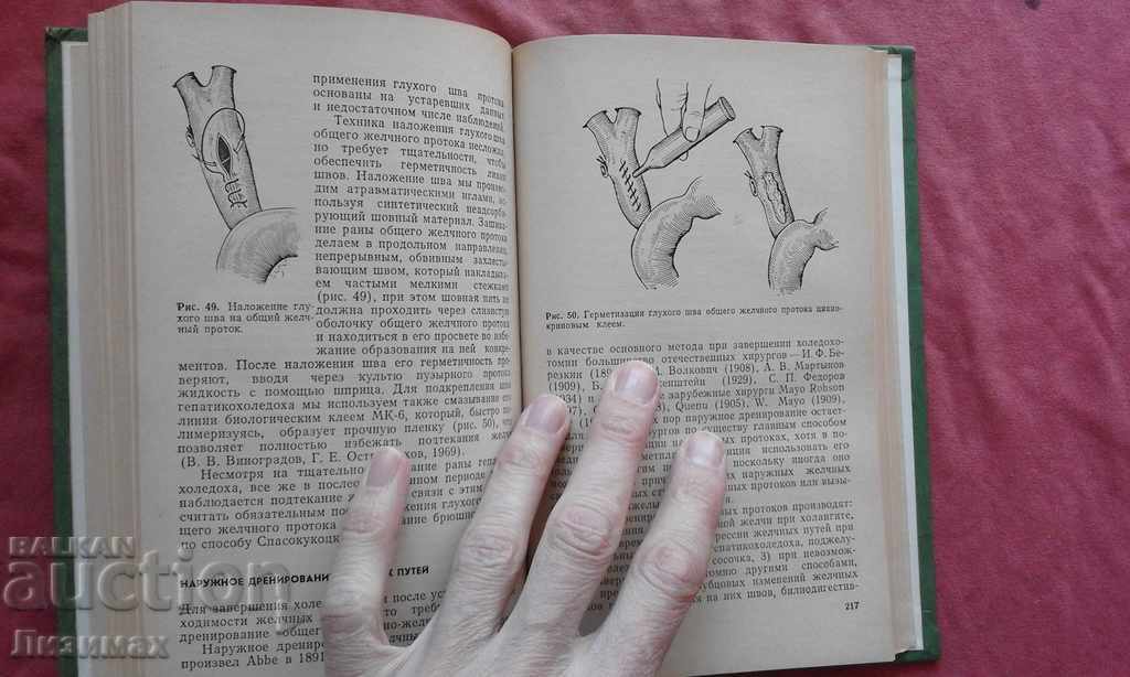 Delivery of Obstruction of the biliary tract Delivery of Obstruction of the biliary tract