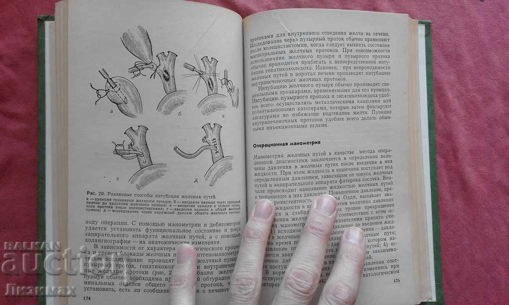 Obstruction of the biliary tract - 6 Obstruction of the biliary tract - 6