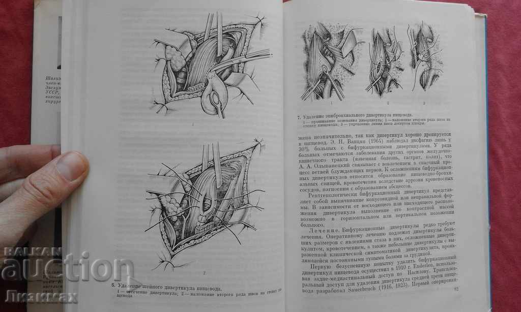 Delivery of Esophageal surgery - AA Shalimov, VF Saenko Delivery of Esophageal surgery - AA Shalimov, VF Saenko