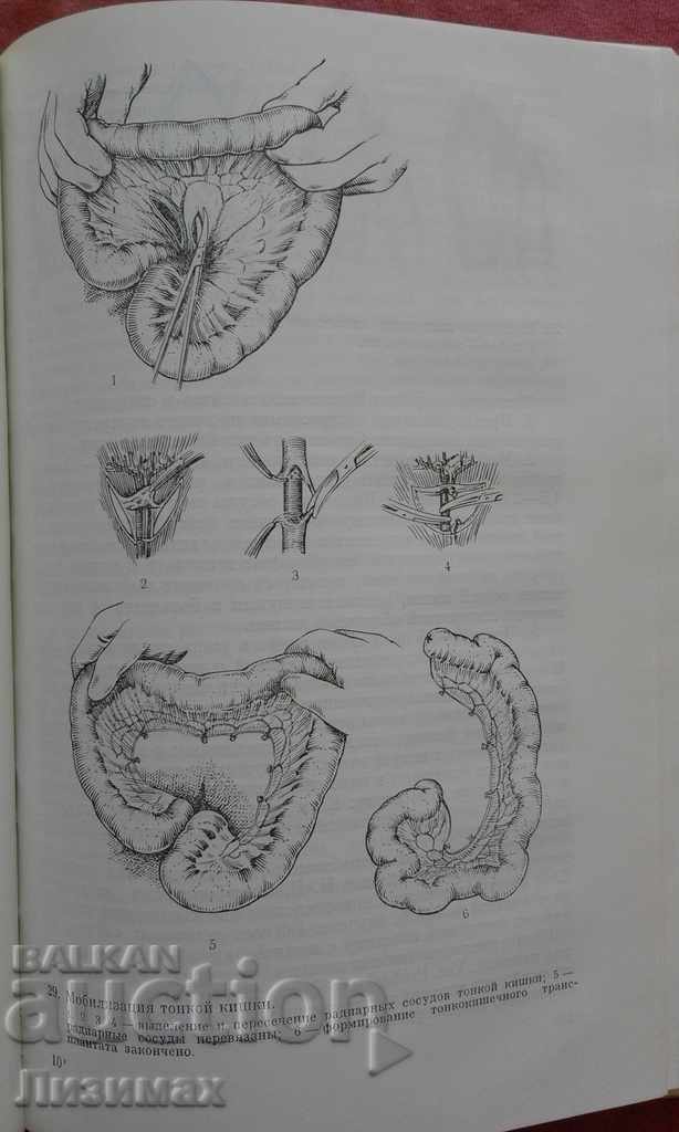 Chirurgia esofagului - Șalimov A.A., Saenko V.F - 5