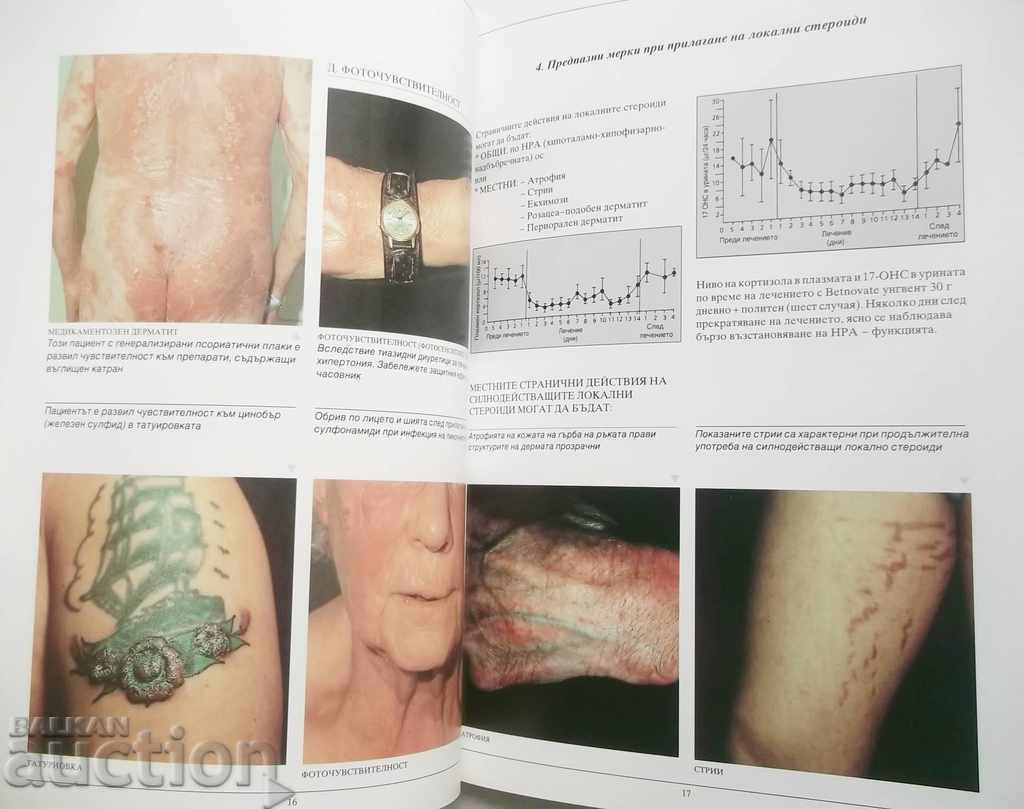 Παράδοση Τοπική θεραπεία στεροειδών στην πράξη - P. Woodbridge Παράδοση Τοπική θεραπεία στεροειδών στην πράξη - P. Woodbridge