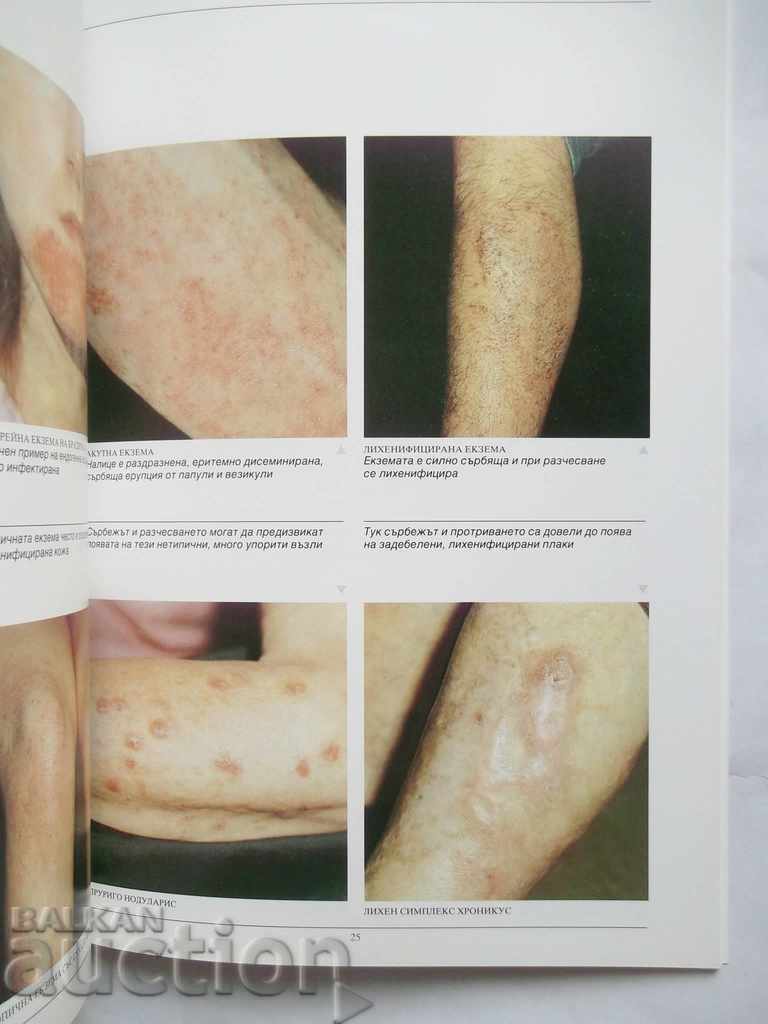 Τοπική θεραπεία στεροειδών στην πράξη - P. Woodbridge - 5 Τοπική θεραπεία στεροειδών στην πράξη - P. Woodbridge - 5