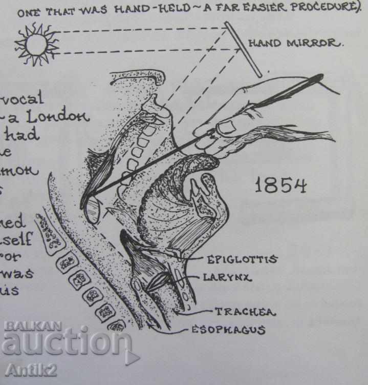 19 век Антикварен Медицински Ларингоскоп с цена 200.00 лв. | € 102.26 19 век Антикварен Медицински Ларингоскоп с цена 200.00 лв. | € 102.26