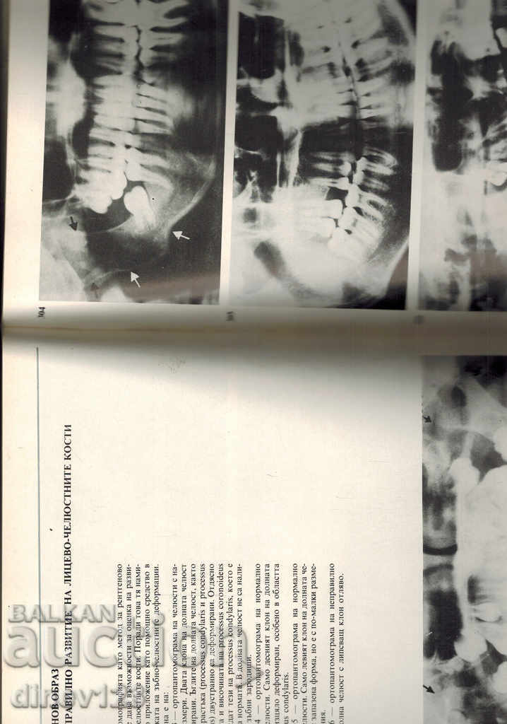 Auction  DENTAL X-ray ATLAS