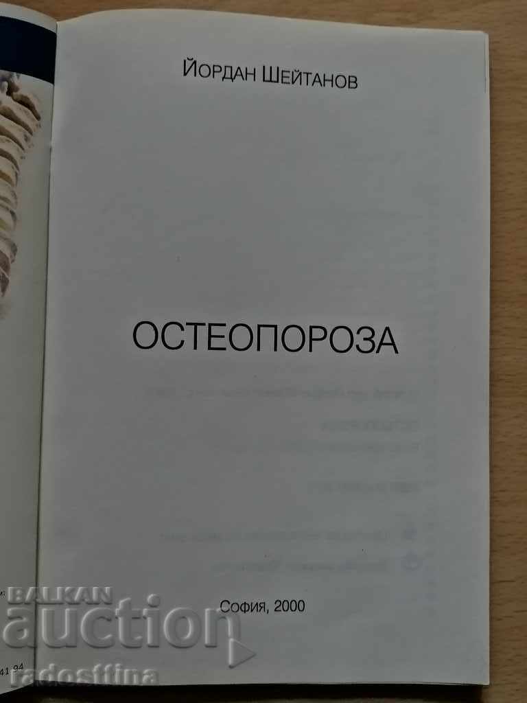 Delivery of Osteoporosis Jordan Sheitanov Delivery of Osteoporosis Jordan Sheitanov