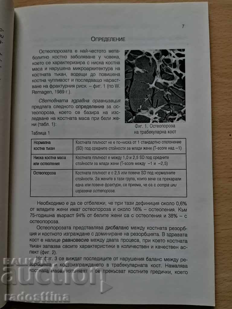 Osteoporosis Jordan Sheitanov - 5 Osteoporosis Jordan Sheitanov - 5