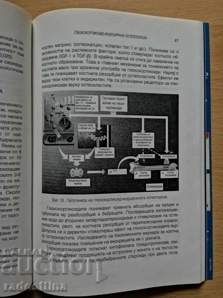 Osteoporosis Jordan Sheitanov - 6 Osteoporosis Jordan Sheitanov - 6