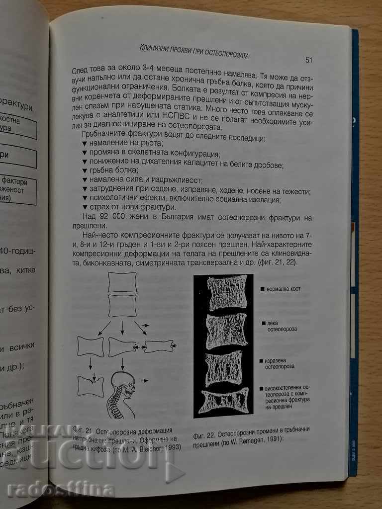 Osteoporosis Jordan Sheitanov - 7 Osteoporosis Jordan Sheitanov - 7