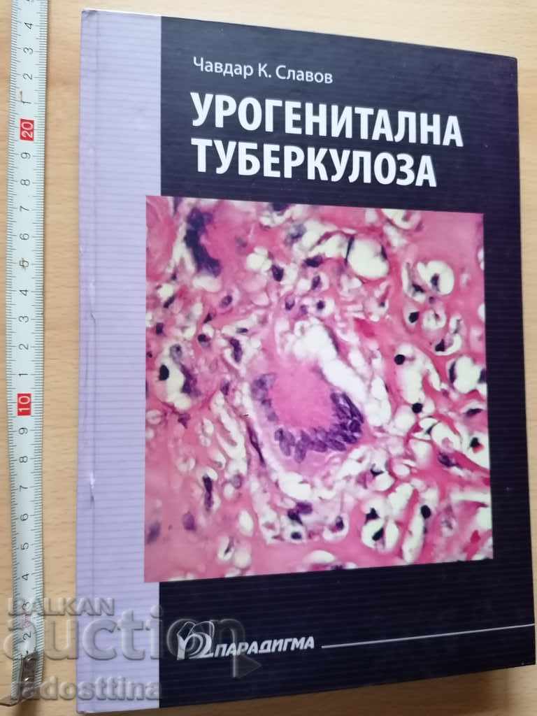 Urogenital tuberculosis C. Slavov