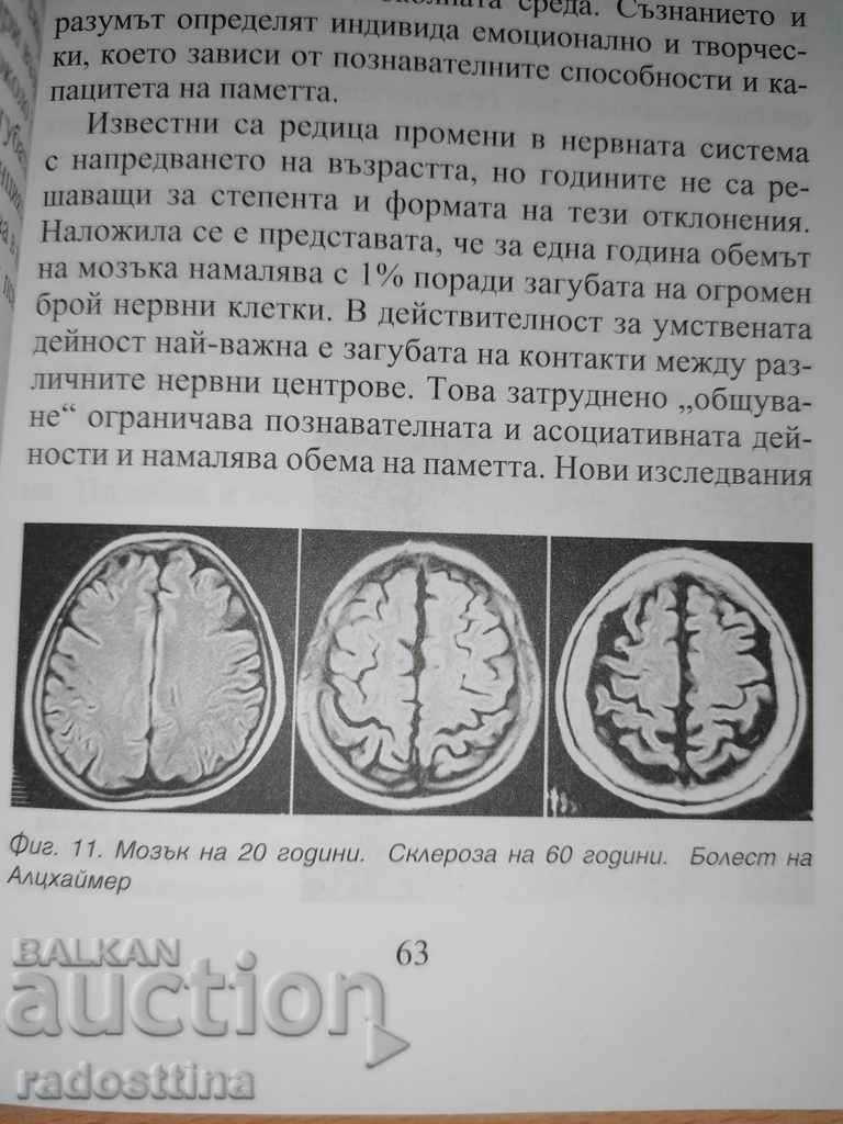 Delivery of Aging slowly is an art Dimitar Chavdarov
