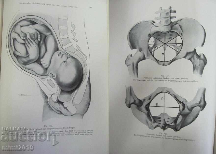 1922 Medical Book Germany - 7