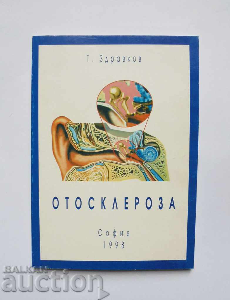 Отосклероза - Т. Здравков 1999 г.