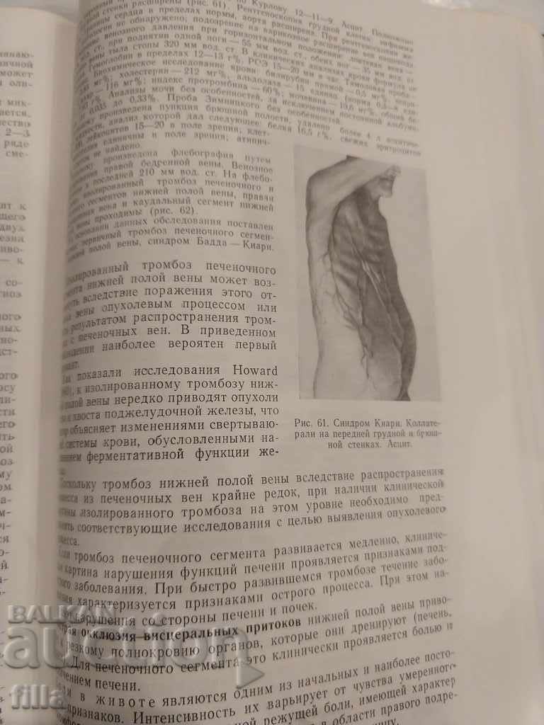 Auction Medicine, Diseases of the main veins Auction Medicine, Diseases of the main veins