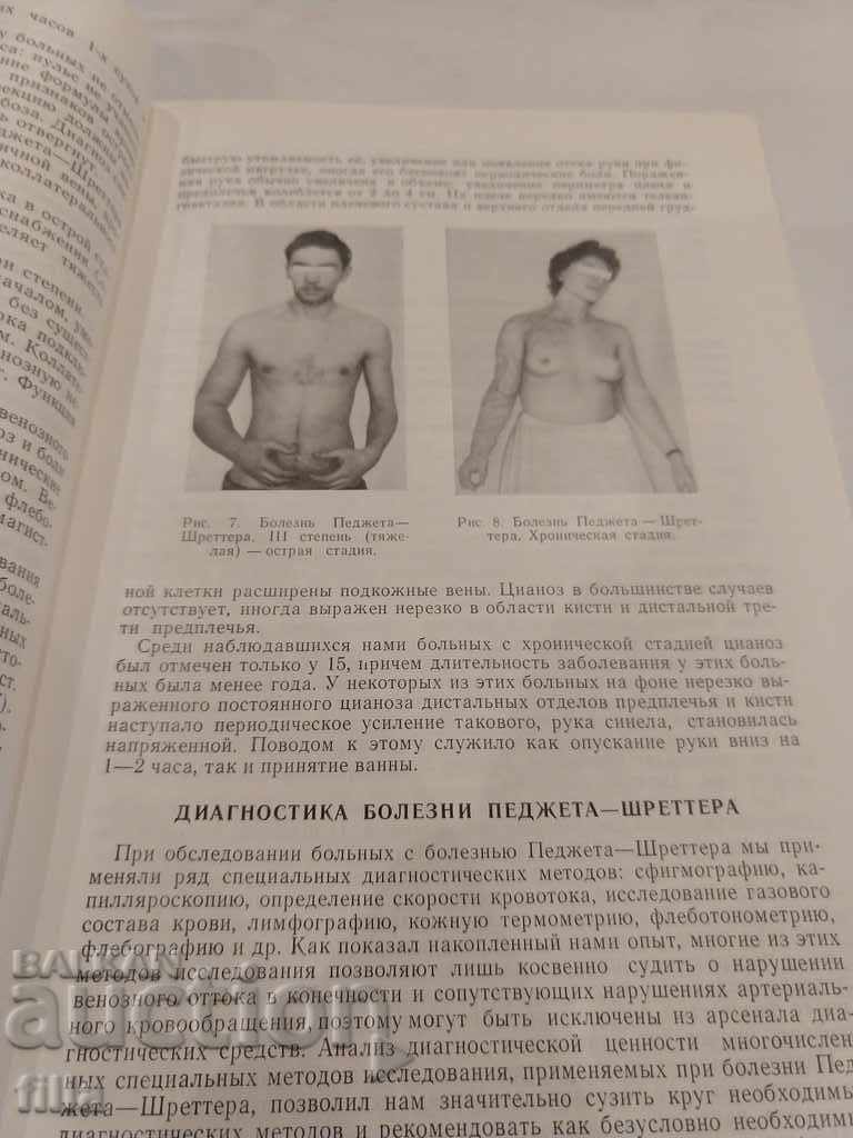 Medicine, Diseases of the main veins - 5 Medicine, Diseases of the main veins - 5