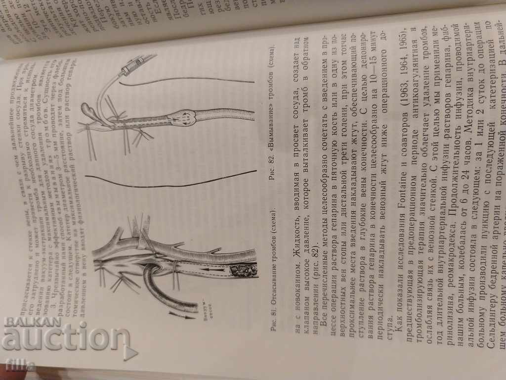 Medicine, Diseases of the main veins - 6 Medicine, Diseases of the main veins - 6