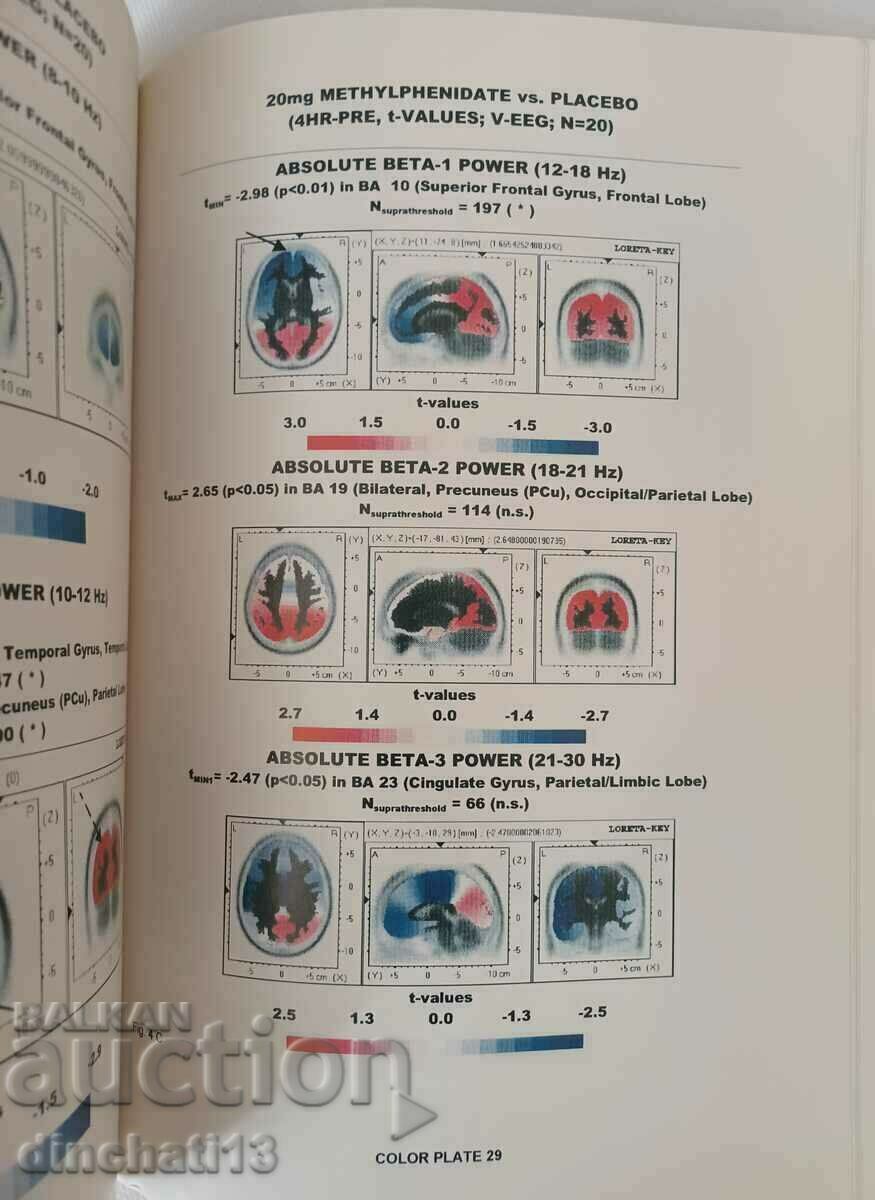 Electrophysiological Brain Research in Preclinical and ... - 5