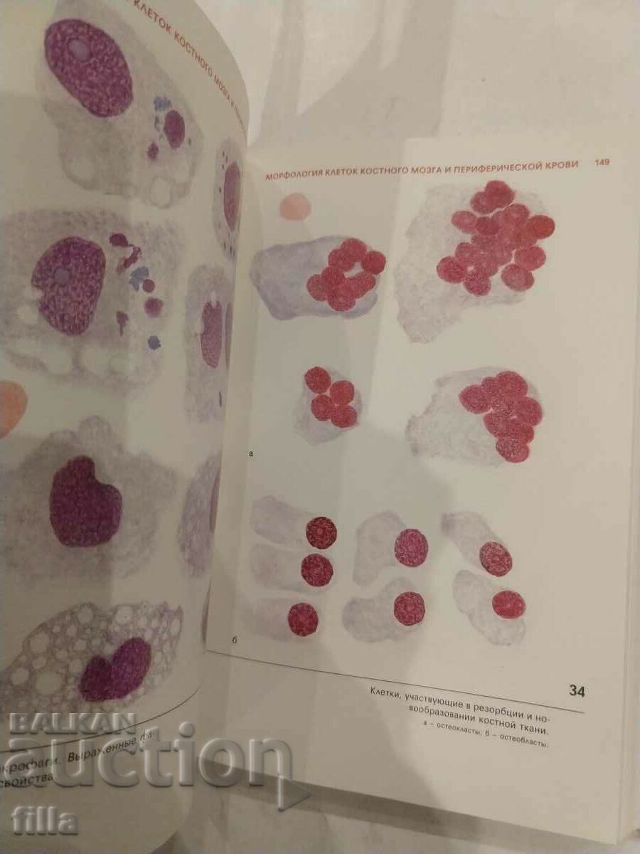 Medicine, Hematological Atlas - 5 Medicine, Hematological Atlas - 5