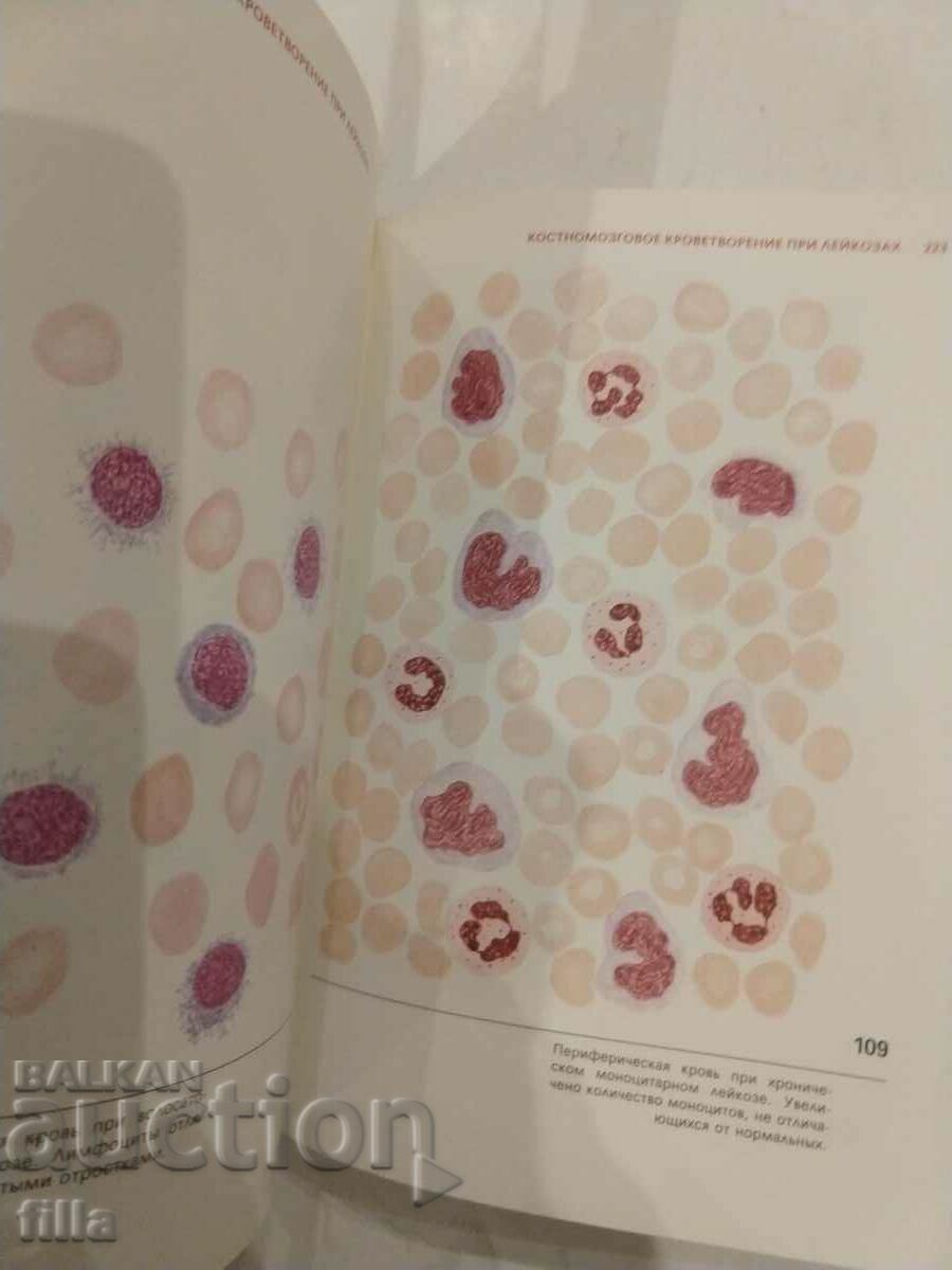 Medicine, Hematological Atlas - 7 Medicine, Hematological Atlas - 7