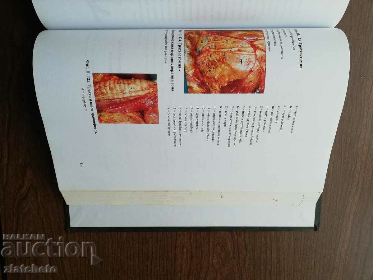 Delivery of Rosen Drebov - Congenital surgical diseases of the neck in .. Delivery of Rosen Drebov - Congenital surgical diseases of the neck in ..